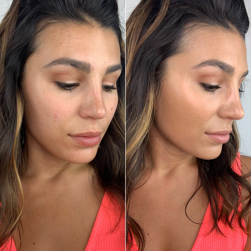 Does AEROBLEND Have Enough Coverage For My Problem Areas?